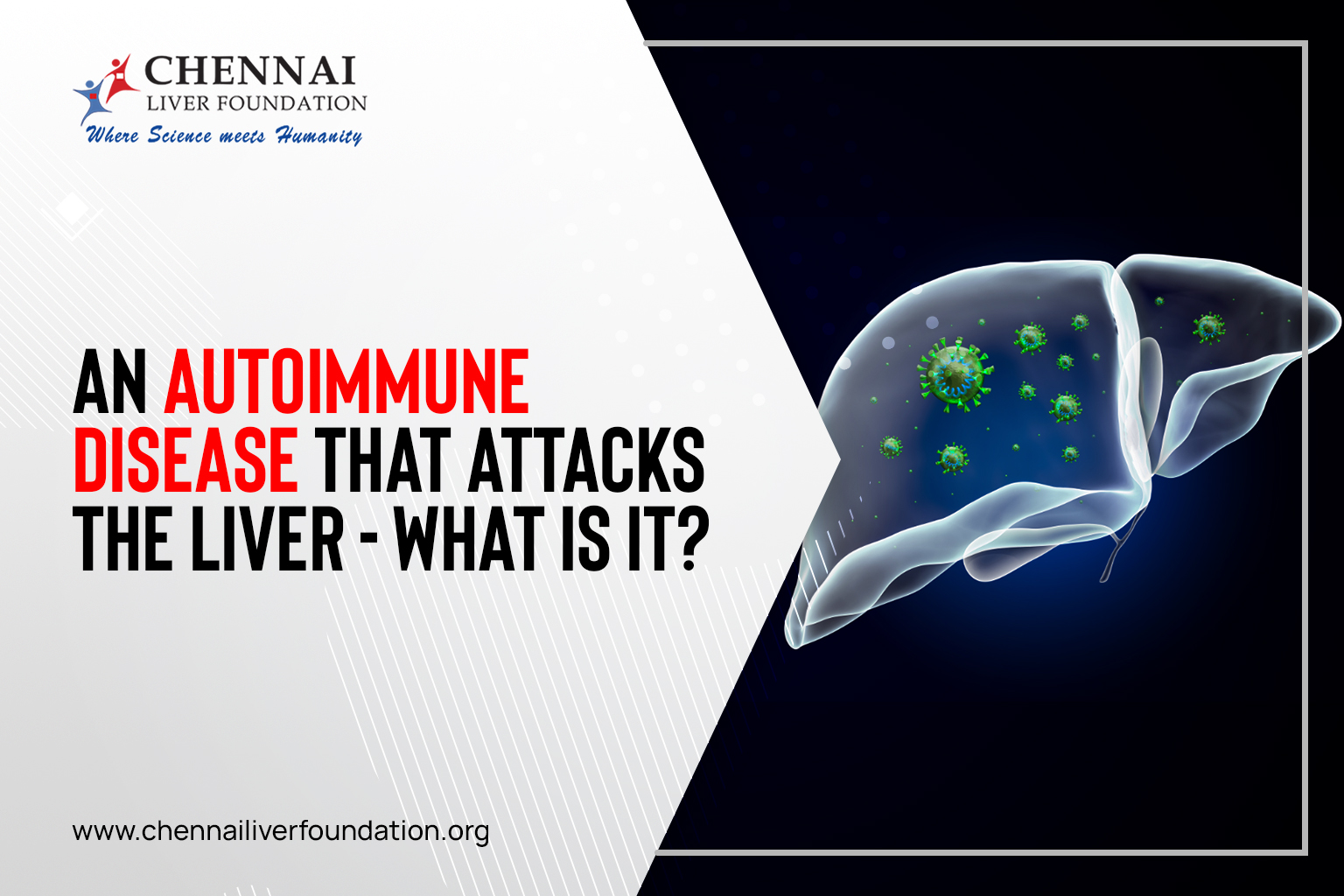 An AutoImmune Disease That Attacks The Liver What Is It Chennai 