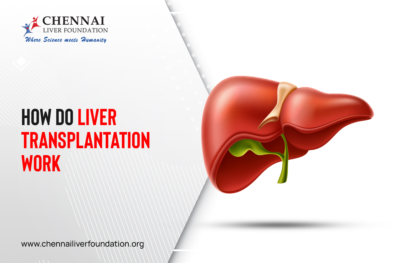 How do liver transplantations work? Here’s what you need to know