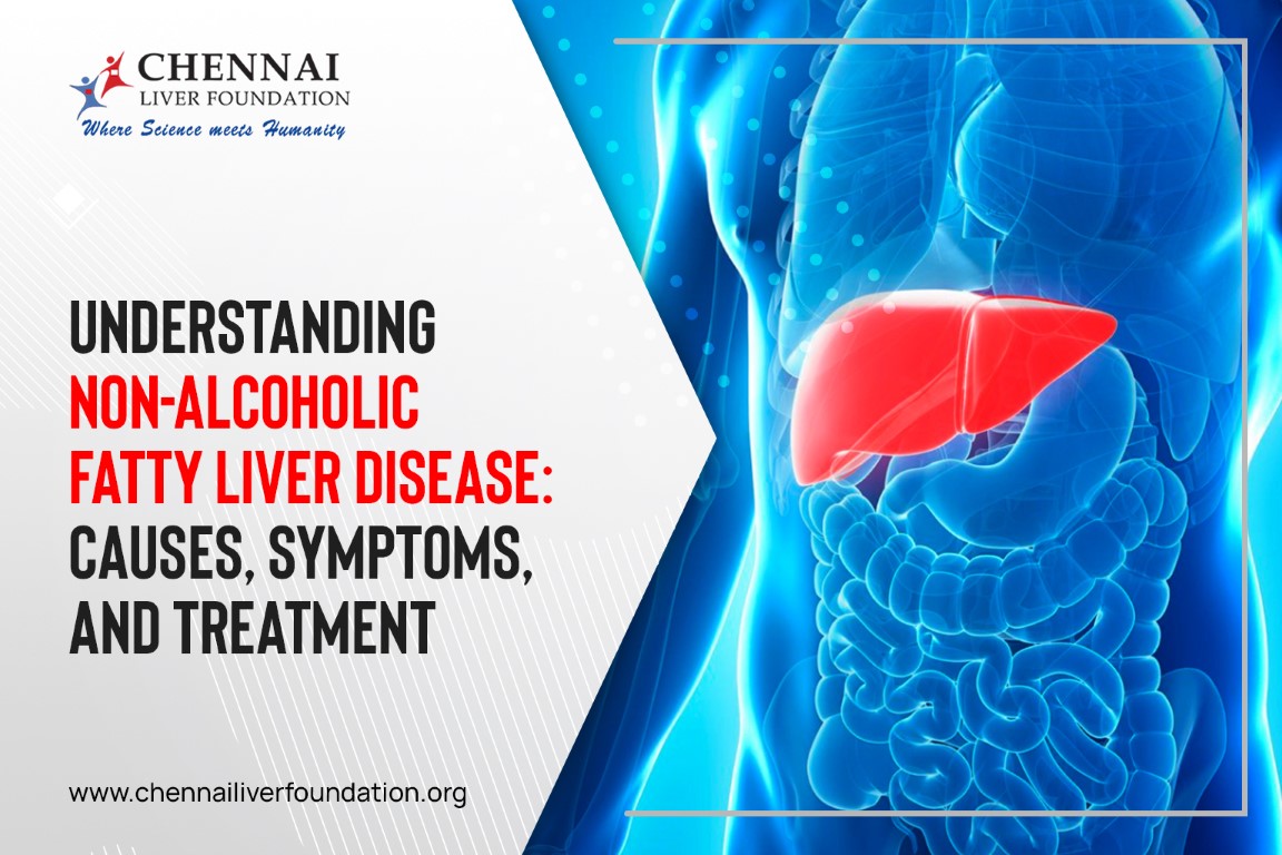 Understanding Non-Alcoholic Fatty Liver Disease: Causes, Symptoms, and Treatment